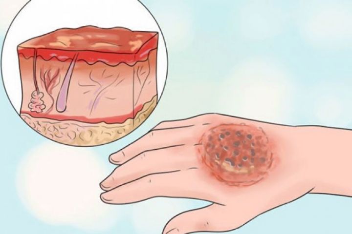 راه اندازی لیزر درمانی در بیمارستان امیرالمومنین راه اندازی لیزر درمانی در بیمارستان امیرالمومنین