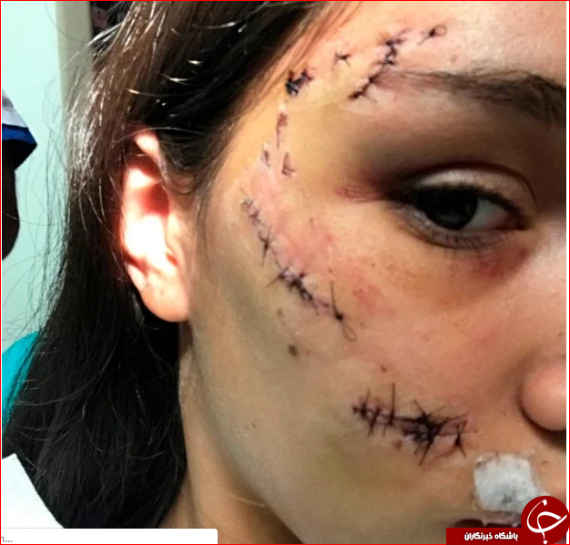 پشیمانی دختر آرژانتینی از عکس گرفتن با سگ پشیمانی دختر آرژانتینی از عکس گرفتن با سگ