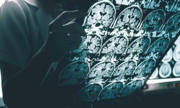 اضافه وزن با کاهش عقل در ارتباط است اضافه وزن و کاهش عقل