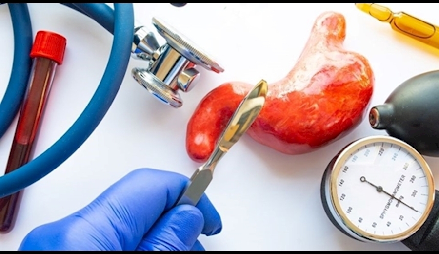 کوچک کردن معده معجزه نمیکند، سبک زندگی را اصلاح کنید کوچک کردن معده معجزه نمیکند، سبک زندگی را اصلاح کنید