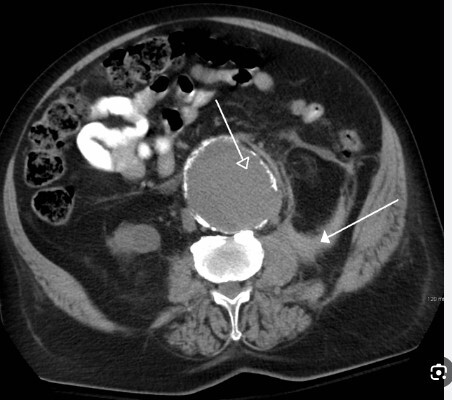 *** ابداع روش تصویربرداری جدید در تشخیص سرطان سینه *** ابداع روش تصویربرداری جدید در تشخیص سرطان سینه