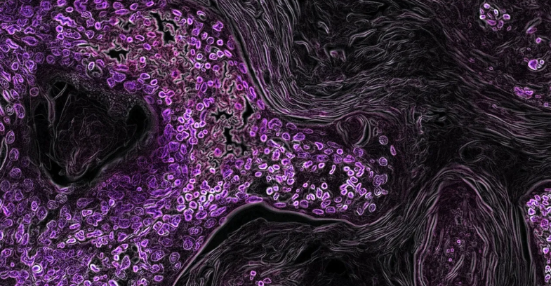 طراحی ابزاری جدید که رفتار سلول‌های سرطانی را شفاف می‌کند