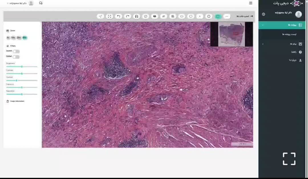 بهره‌مندی از سامانه تشخیص سرطان توسط یک شرکت دانش بنیان در ارومیه