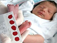غربالگری ۹۹ درصدی تیروئید نوزادان زیر مجموعه دانشگاه علوم پزشکی مشهد